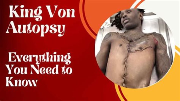 How Did Von Die? Exploring the Life, Legacy, and Circumstances of Von's Death